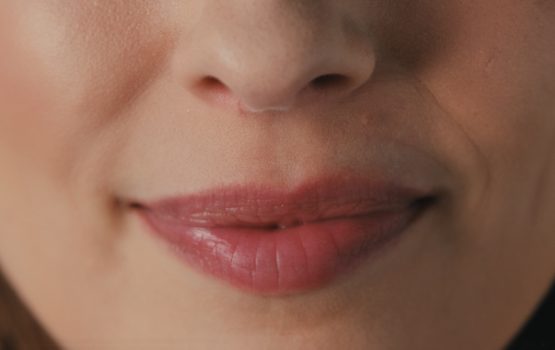 Lippenherpes (Herpes labialis)